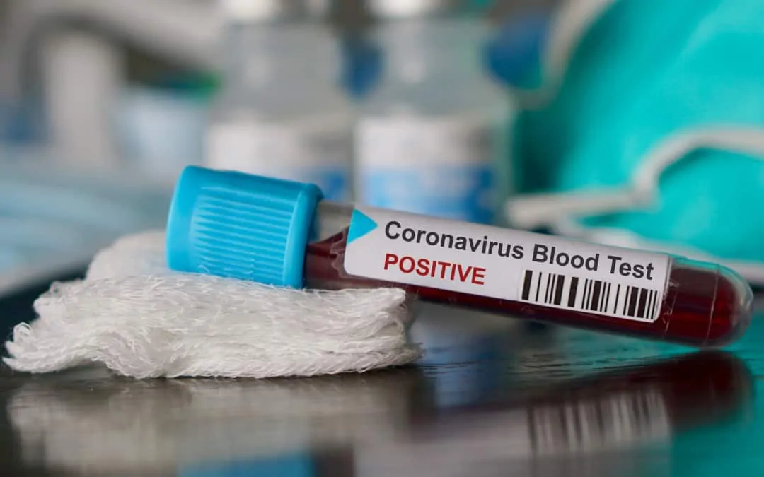 How to get tested for coronavirus in the NT