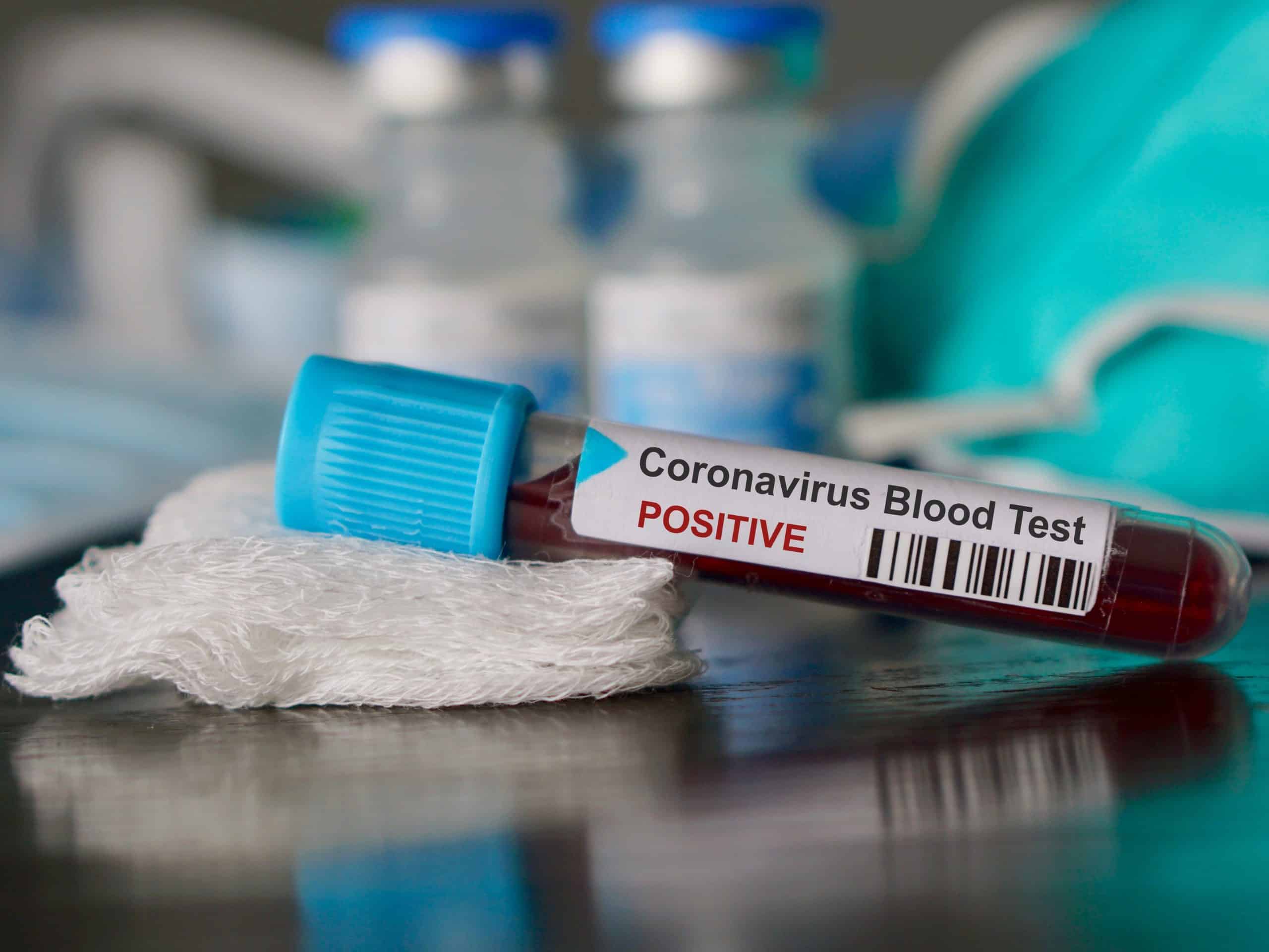 Coronavirus test 4:3