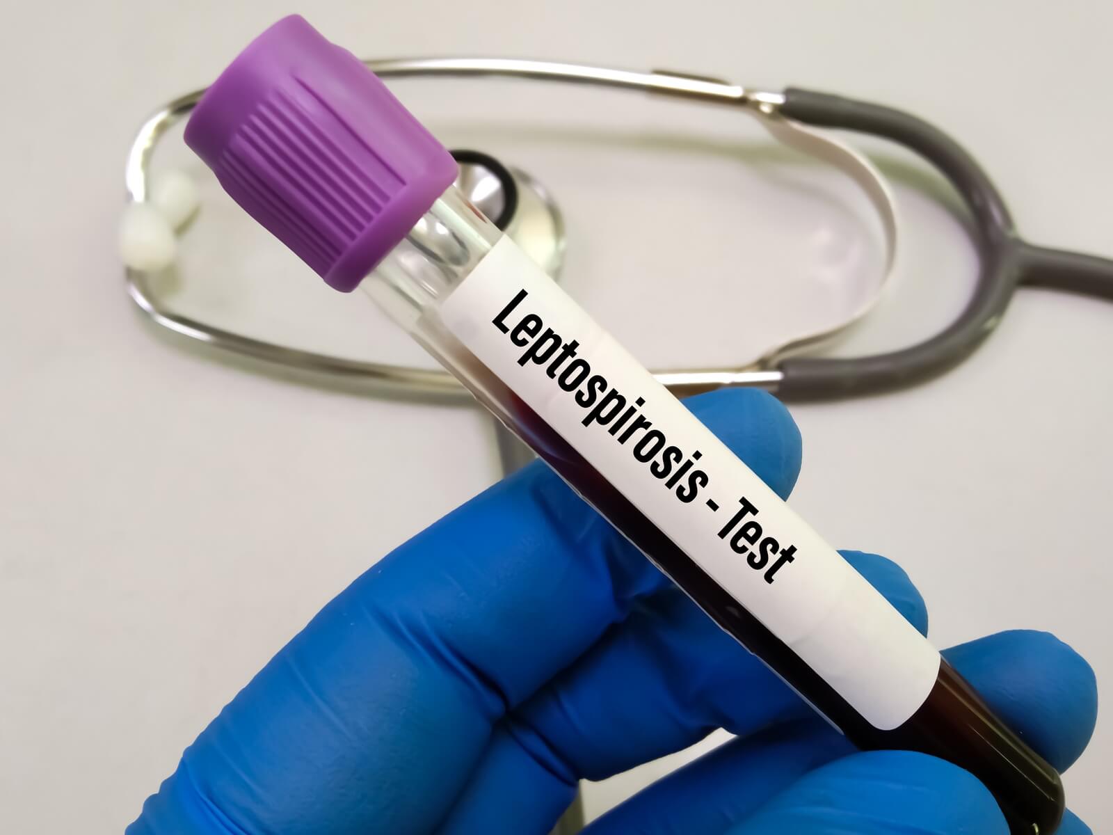 Lepto test Cropped