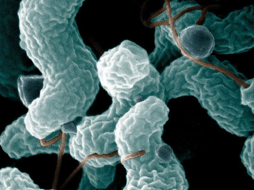 gastro bacteria pic Cropped