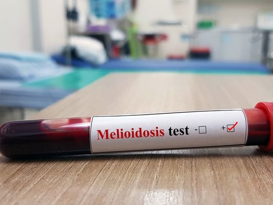 melioidosis_PIC Cropped