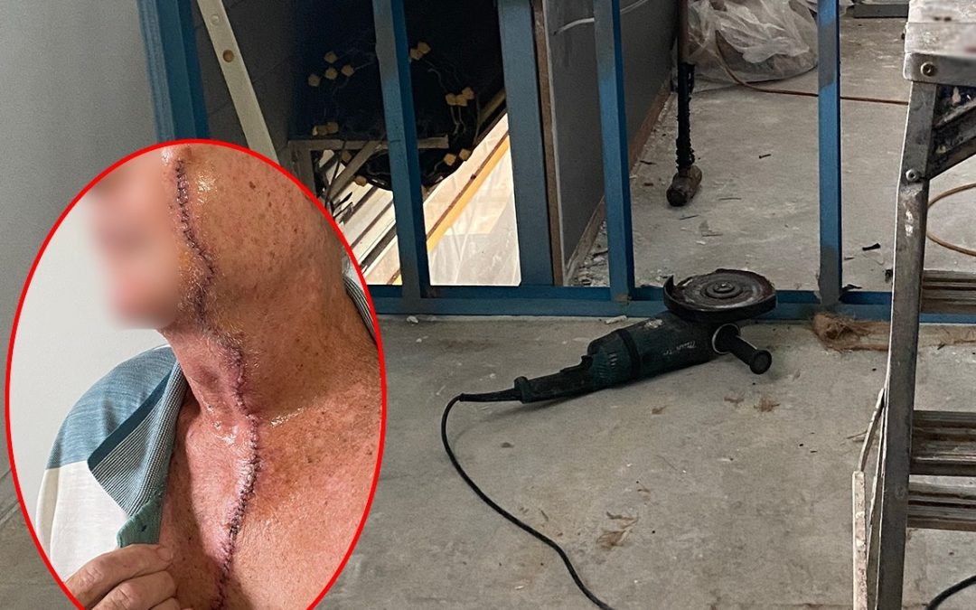 Worker’s face and throat sliced by angle grinder prompting NT WorkSafe alert