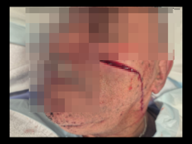 Man who had face slashed in Alice Springs attack is a corrections officer: Union