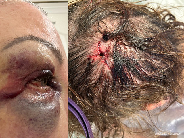 Woman who was bashed